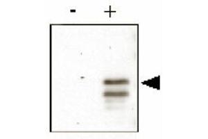 Anti-CREB pS133 was used to detect phosphorylated CREB by immunoblot. (CREB1 Antikörper  (pSer133))