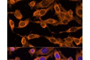 Immunofluorescence analysis of HeLa cells using USP36 Polyclonal Antibody at dilution of 1:100 (40x lens). (USP36 Antikörper)