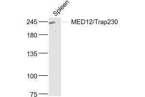 Mouse spleen lysates probed with MED12/Trap230 Polyclonal Antibody, Unconjugated  at 1:300 dilution and 4˚C overnight incubation. (MED12 Antikörper  (AA 251-350))