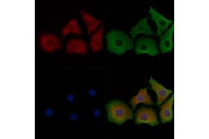 ABIN6261881, ABIN6267053, ABIN6267054 and ABIN6267055 staining Hela cells by IF/ICC. (GAPDH Antikörper)