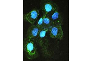 anti-Angiotensin I Converting Enzyme (Peptidyl-Dipeptidase A) 1 (ACE) (AA 651-864) antibody