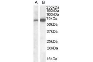 Western Blotting (WB) image for anti-Eukaryotic Elongation Factor, Selenocysteine-tRNA-Specific (EEFSEC) (C-Term) antibody (ABIN2790209) (EEFSEC Antikörper  (C-Term))
