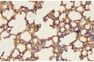 Immunohistochemistry (Paraffin-embedded Sections) (IHC (p)) image for anti-Annexin A5 (ANXA5) antibody (ABIN7234405)