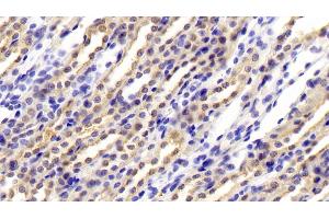 Detection of CFB in Rat Kidney Tissue using Polyclonal Antibody to Complement Factor B (CFB) (Complement Factor B Antikörper  (AA 34-159))