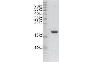 Recombinant BRD4 (333-460) protein gel.