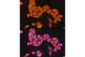Immunofluorescence analysis of HeLa cells using Rap1B Rabbit pAb (ABIN6132985, ABIN6146685, ABIN6146686 and ABIN6216738) at dilution of 1:100 (40x lens). (RAP1B Antikörper  (AA 1-184))