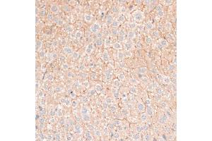 Immunohistochemistry of paraffin-embedded mouse liver using CDH18 antibody (ABIN6291131) at dilution of 1:100 (40x lens). (CDH18 Antikörper)