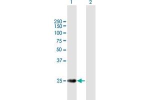 Western Blot analysis of TERF2 expression in transfected 293T cell line by TERF2 MaxPab polyclonal antibody. (TRF2 Antikörper  (AA 1-251))