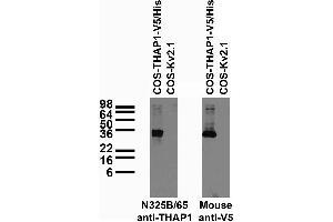 Adult rat hippocampus immunohistochemistry.