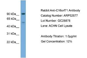 WB Suggested Anti-C16orf71  Antibody Titration: 0. (C16ORF71 Antikörper  (Middle Region))