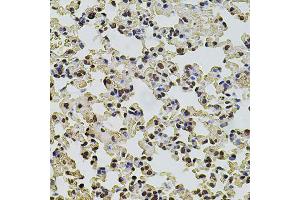 Immunohistochemistry of paraffin-embedded mouse lung using POT1 antibody. (POT1 Antikörper)