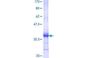 Image no. 1 for Prostate Stem Cell Antigen (PSCA) (AA 23-95) protein (GST tag) (ABIN1316512) (PSCA Protein (AA 23-95) (GST tag))