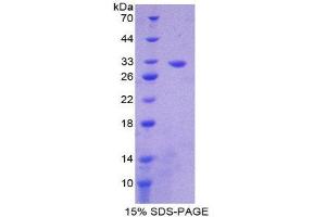 SDS-PAGE (SDS) image for Citrate Synthase (CS) (AA 56-312) protein (His tag) (ABIN1878712) (CS Protein (AA 56-312) (His tag))