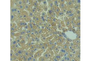Used in DAB staining on fromalin fixed paraffin- embedded liver tissue (IL1RAP Antikörper  (AA 21-367))