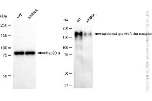 Western blotting analysis using EGFR antibody (ABIN7798480).