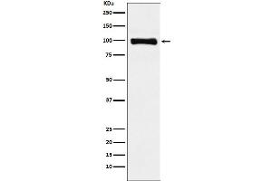 Western blot analysis of PIWIL1 expression in HepG2 cell lysate.