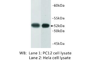 Image no. 1 for anti-Tubulin B antibody (ABIN1112941) (Tubulin B Antikörper)