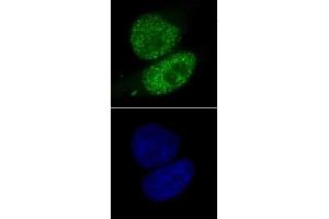 SMARCA4 antibody (mAb) (Clone 5B7) tested by immunofluorescence. (SMARCA4 Antikörper  (AA 213-295))