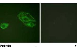 Immunofluorescence analysis of A-549 cells, using ERBB3 polyclonal antibody . (ERBB3 Antikörper)