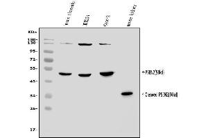 Western blot analysis of Presenilin 2/AD5/PSEN2 using anti-Presenilin 2/AD5/PSEN2 antibody (ABIN7602796).
