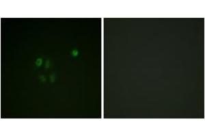 Immunofluorescence analysis of A549 cells, using Chk1 (Ab-301) Antibody. (CHEK1 Antikörper  (AA 271-320))