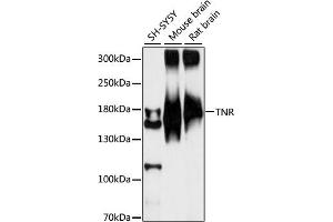 Western blot analysis of extracts of various cell lines, using TNR antibody (ABIN7270766) at 1:1000 dilution. (Tenascin R Antikörper  (AA 1059-1358))