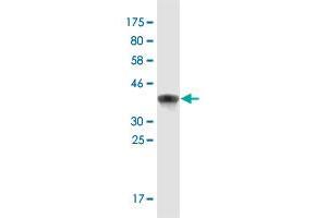 Western Blotting (WB) image for anti-Nuclear Factor of Activated T-Cells 5, Tonicity-Responsive (NFAT5) (AA 1422-1531) antibody (ABIN2565718)
