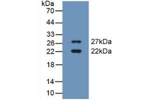 Detection of Recombinant CIRBP, Human using Polyclonal Antibody to Cold Inducible RNA Binding Protein (CIRBP) (CIRBP Antikörper  (AA 1-172))