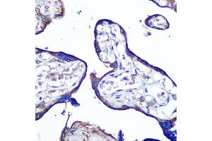 Immunohistochemistry of paraffin-embedded human placenta using JAM-A/CD321/F11R Rabbit pAb (ABIN3021822, ABIN3021823, ABIN3021824, ABIN1512881 and ABIN6216028) at dilution of 1:100 (40x lens).
