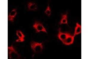 Immunofluorescent analysis of Cullin 5 staining in SW480 cells. (Cullin 5 Antikörper)