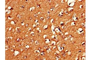 Immunohistochemistry of paraffin-embedded human brain tissue using ABIN7154668 at dilution of 1:100 (GNG11 Antikörper  (AA 1-70))