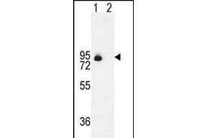 Western blot analysis of ENG (arrow) using rabbit polyclonal ENG Antibody (Center) (ABIN655186 and ABIN2844801). (Endoglin Antikörper  (AA 265-294))