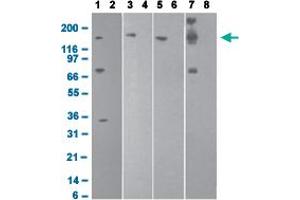 Western blot analysis with DNMT1 monoclonal antibody, clone 60B1220. (DNMT1 Antikörper  (AA 637-650))