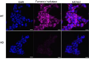 Immunocytochemical staining of HeLa cells using Fumarate hydratase antibody (ABIN7798665), 1:1,000), Top panel: wild-type (WT), Bottom panal: Fumarate hydratase shRNA knockdown (KD). (FH Antikörper)