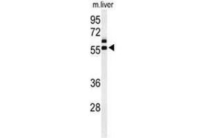 Western blot analysis of AMH Antibody (Center) in mouse liver tissue lysates (35 µg/lane).