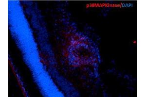 Immunohistochemistry analysis using Mouse Anti-p38 MAPK Monoclonal Antibody, Clone 9F12 . (MAPK14 Antikörper  (PE))