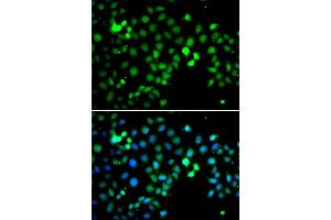 Immunofluorescence analysis of A549 cell using MTF2 antibody. (MTF2 Antikörper)