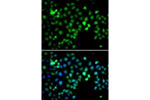 Immunofluorescence analysis of A549 cell using MTF2 antibody. (MTF2 Antikörper)