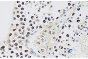 Immunohistochemistry of paraffin-embedded Mouse testis using CCNE2 Polyclonal Antibody at dilution of 1:100 (40x lens). (Cyclin E2 Antikörper)