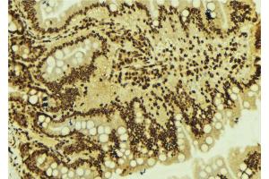 ABIN6273604 at 1/100 staining Mouse colon tissue by IHC-P. (ZNF71 Antikörper)