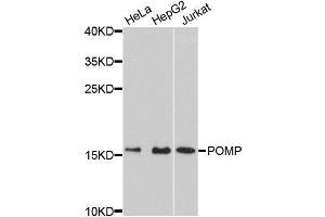 Western blot analysis of extracts of various cell lines, using POMP antibody (ABIN5996666) at 1:3000 dilution. (POMP Antikörper)