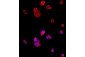 Immunofluorescence (IF) image for anti-Cadherin 1, Type 1, E-Cadherin (Epithelial) (CDH1) (AA 700-800) antibody (ABIN6138279)