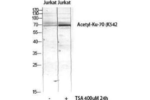 Western Blot (WB) analysis of JK lysis using Acetyl-Ku-70 (K542) antibody. (XRCC6 Antikörper  (acLys542))
