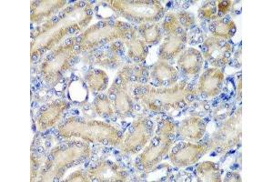 Immunohistochemistry of paraffin-embedded Rat kidney using PDCD6 Polyclonal Antibody at dilution of 1:200 (40x lens). (PDCD6 Antikörper)