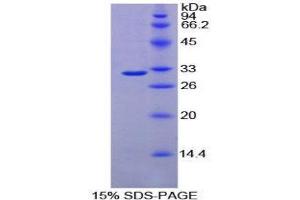 SDS-PAGE (SDS) image for Fucosyltransferase 4 (Alpha (1,3) Fucosyltransferase, Myeloid-Specific) (FUT4) (AA 144-389) protein (His tag,T7 tag) (ABIN1879429)