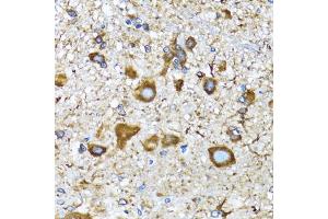 Immunohistochemistry of paraffin-embedded mouse spinal cord using MLC3A antibody (ABIN6134219, ABIN6143466, ABIN6143468 and ABIN6215215) at dilution of 1:100 (40x lens). (MAP1LC3A Antikörper  (AA 1-100))