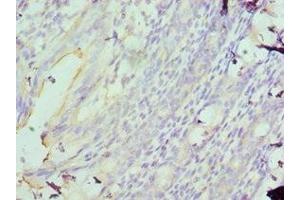 Immunohistochemistry of paraffin-embedded human colon using ABIN7160089 at dilution of 1:100