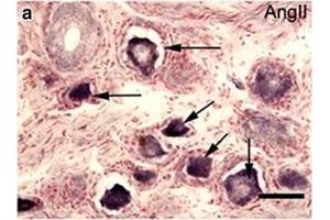 Angiotensin II Antikörper