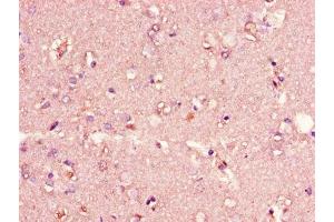 Immunohistochemistry of paraffin-embedded human brain tissue using ABIN7147273 at dilution of 1:100 (CIDEA Antikörper  (AA 1-51))