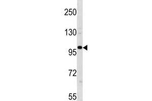 Western Blotting (WB) image for anti-Establishment of Cohesion 1 Homolog 1 (ESCO1) antibody (ABIN3004513) (ESCO1 Antikörper)